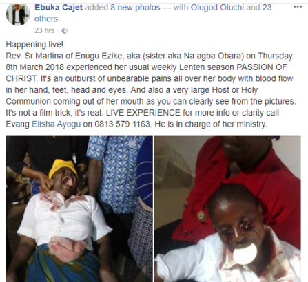 Blood Reportedly Flows from Rev. Sister’s Hand, Feet, Head and Eyes [Photos]