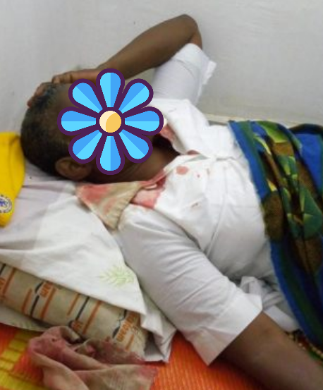 Blood Reportedly Flows from Rev. Sister’s Hand, Feet, Head and Eyes [Photos]