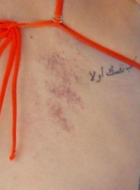 Selena Gomez Spotted Wearing Bikini That Displayed Her Surgery Scars [Photos]