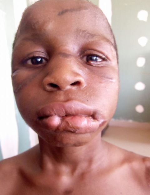 12-Year-Old Maid’s Reproductive System Damaged After Being Tortured By Her Madam [Photos]
