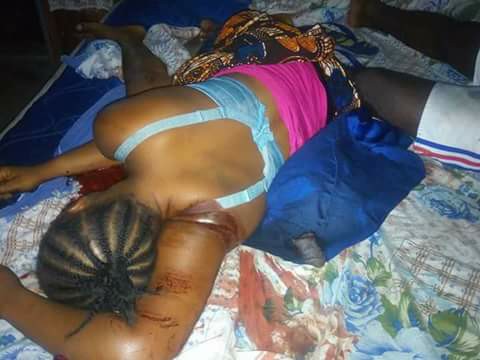 Woman Killed After Cutting Off Her boyfriend’s private part [Graphic Photos]