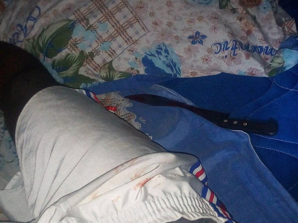 Woman Killed After Cutting Off Her boyfriend’s private part [Graphic Photos]