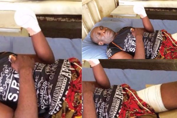 54-Year-Old Farmer Reveals How Herdsmen Cut Off His Hand