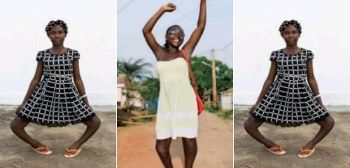 Amazing Transformation Of A Girl Called Witch Due To Her Bow Leg