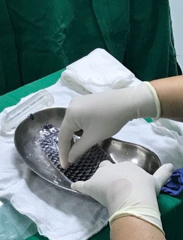 Lady Born Without Vagina Finally Has One Made Out Of Fish Skin [Photos]