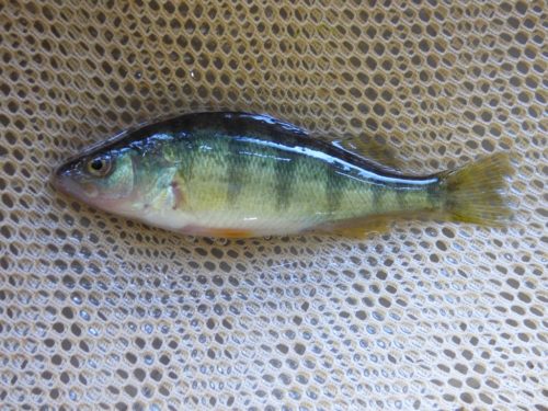 Lady Born Without Vagina Finally Has One Made Out Of Fish Skin [Photos]