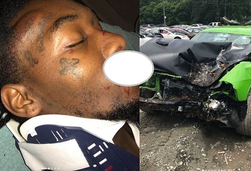 Rapper, offset says he could have been dead as he shows injuries he suffered after his car crash in Atlanta [Graphic Photos]