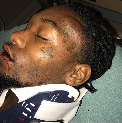 Rapper, offset says he could have been dead as he shows injuries he suffered after his car crash in Atlanta [Graphic Photos]