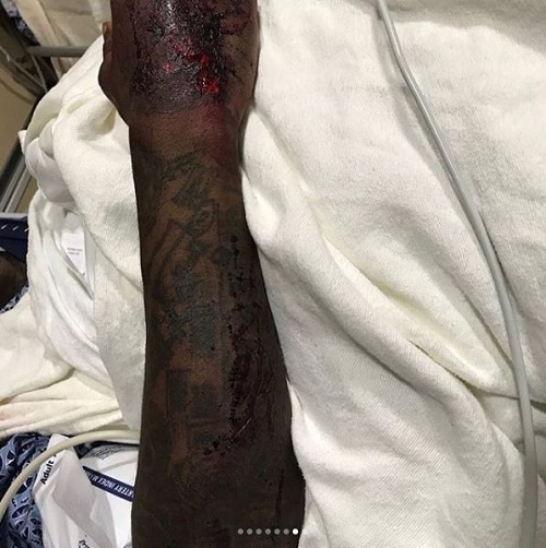 Rapper, offset says he could have been dead as he shows injuries he suffered after his car crash in Atlanta [Graphic Photos]