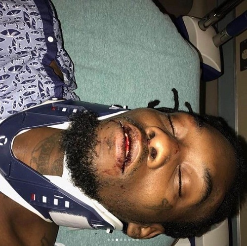 Rapper, offset says he could have been dead as he shows injuries he suffered after his car crash in Atlanta [Graphic Photos]