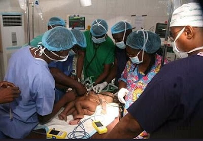 Endless Celebration As FMC Yola Separates Conjoined Female Twins [Photos]