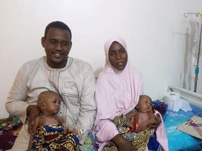 Endless Celebration As FMC Yola Separates Conjoined Female Twins [Photos]