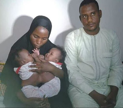 Endless Celebration As FMC Yola Separates Conjoined Female Twins [Photos]