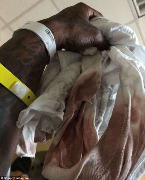 Rapper Lil Scrappy Fighting For His Life In Near-Death Car Crash After Falling Asleep Behind The Wheel [Photos]