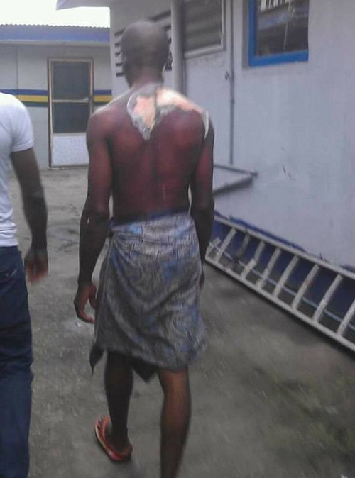 Angry Woman Baths Husband With Hot Water For Doing This To Her [Photos]