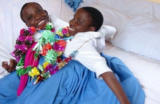 So Sad! Popular Conjoined Twins Maria and Consolata Is Dead