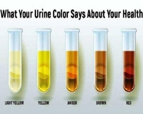 8 basic Urine Colours And What Each Says About Your Health
