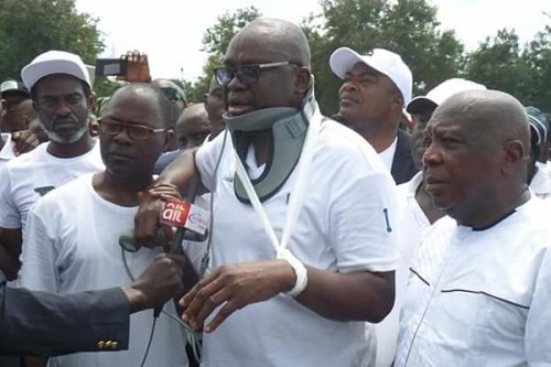 Ekiti 2018: More Photos of “Injured” Governor Fayose Addressing People With Neck Collar [Photos]