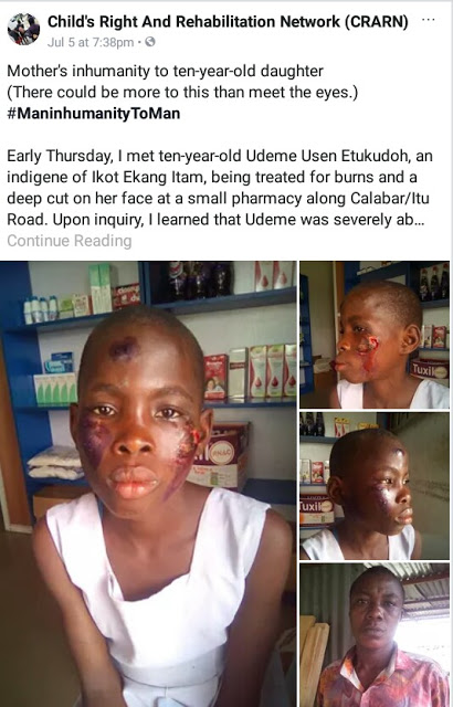 Heartless Mother Burns her 10-Year-Old Daughter’s Face with Electric Iron over Missing 200 Naira [Photos]
