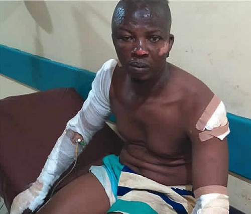 Lagos Tanker Explosion: “It Was Like War, We Thought the End Has Come”, Survivors Narrate Experience and How He Survived