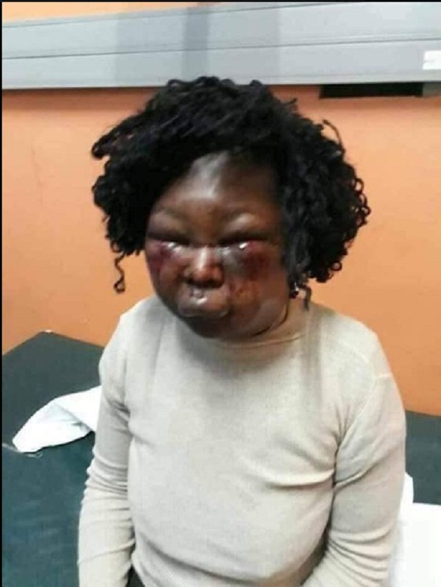 Just Look at What This Man Did To His Wife Just Because Of Food [Photos]