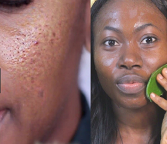 10 Ways To Get A Smooth Skin Without Applying Chemicals In Few Days – These Tips Work Like Magic On Your Face