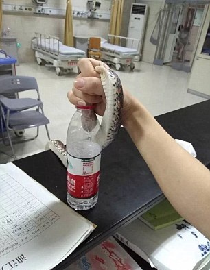 See What This Brave Woman Did To A SNAKE That Bit Her [Photos]