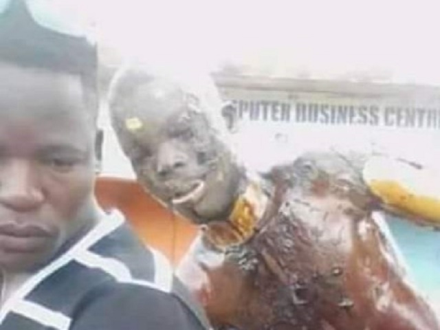 OMG! Viral Photos of a Nasarawa Gas Explosion Victim Getting On a Motorcycle to Take Himself to Hospital