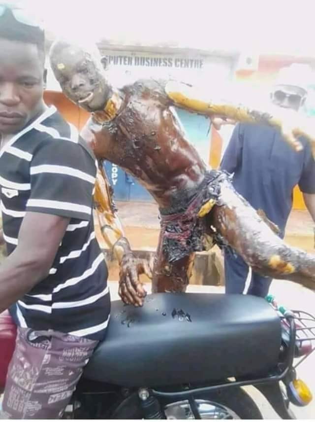 OMG! Viral Photos of a Nasarawa Gas Explosion Victim Getting On a Motorcycle to Take Himself to Hospital
