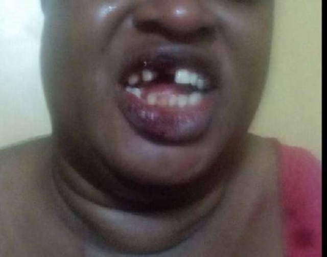 Man knocks off cex Worker’s Teeth during cex, You Won’t Believe What She Did
