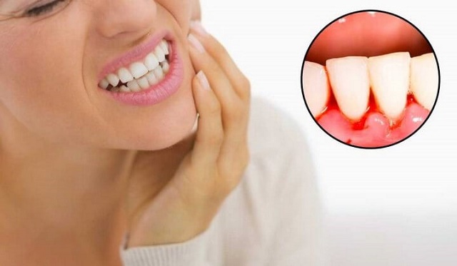 8 Important Dental Health Facts That Everyone Should Know About