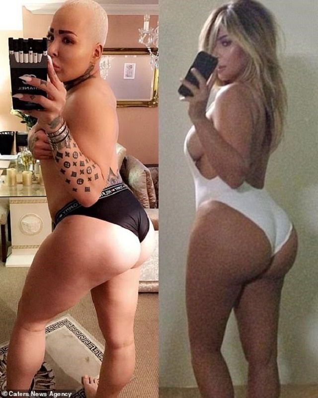Kim Kardashian's Die Hard Male Fan Went Under a Knife to Have the Same Backside as Her [Photos]