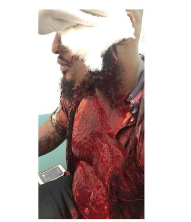 Wizkid’s Bodyguard, Roy Emmanuel, Macheted for Defending Him [Graphic Photos]