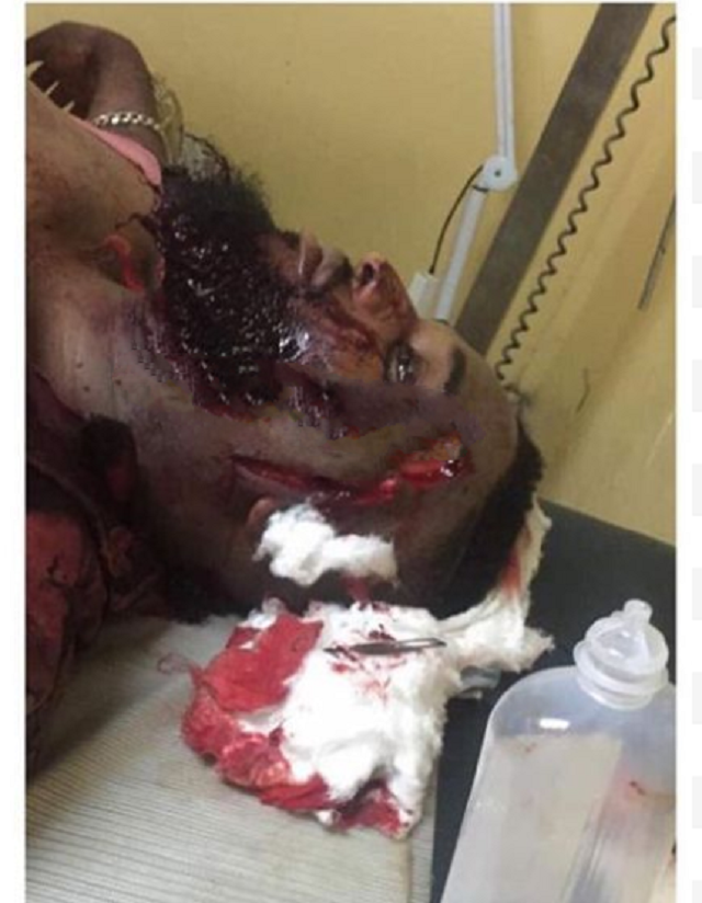 Wizkid’s Bodyguard, Roy Emmanuel, Macheted for Defending Him [Graphic Photos]