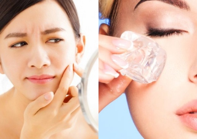 10 Natural Ways to Remove Acne Scars