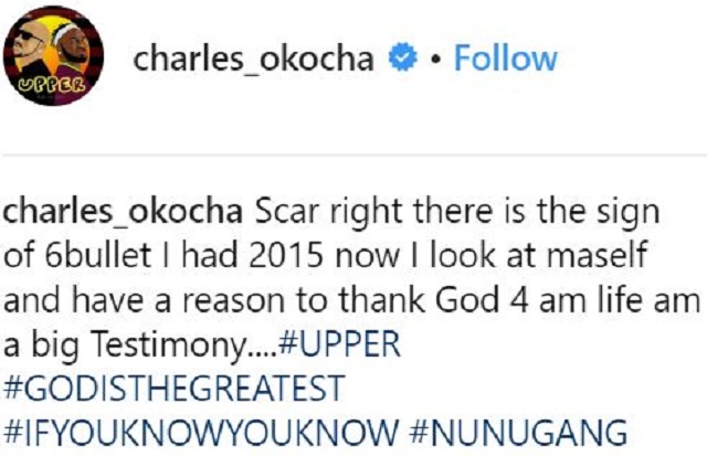 Photos of Charles Okocha As He Displays the Scars of Six Bullets He Survived In 2015
