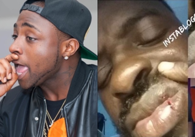 Davido Declare Wanted In Gambia for Brutalizing A Photographer [Photos]