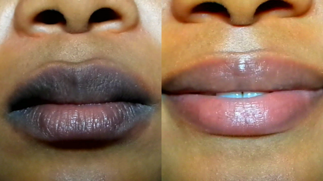 5 Homemade Remedies That Will Naturally Give You Pink Lips within A Week
