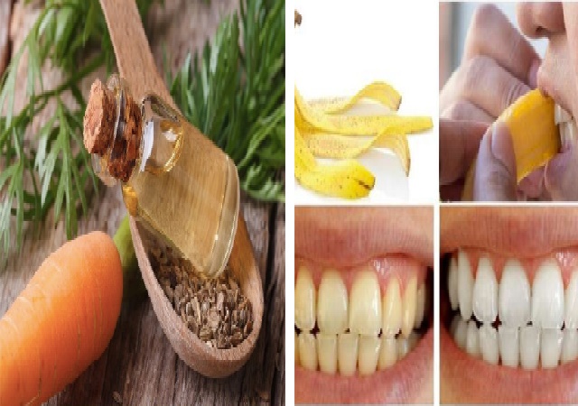 Top 10 Foods You Need To Eat For Healthy Teeth and Gums