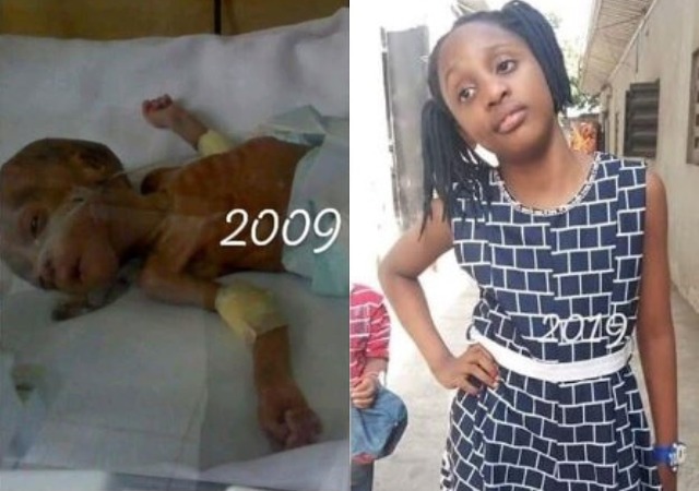 See the Beautiful Face of the Little Girl Who Won the Viral #10yearschallenge