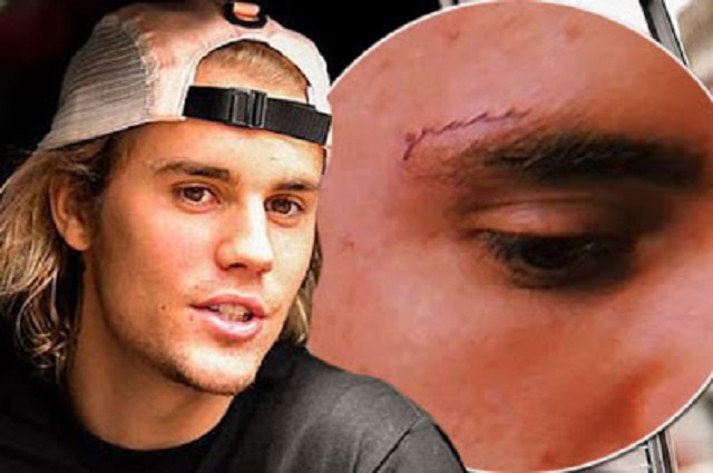 Justin Bieber's Face Tattoo Finally Revealed