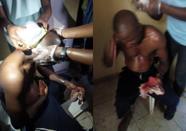 Angry Fans Beats Nigerian Referee Mercilessly After Match [Photos]
