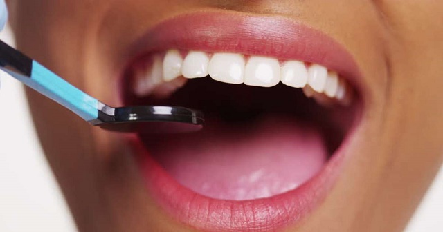 5 Ways To Naturally Whiten Your Teeth At Home Within 5 Minutes