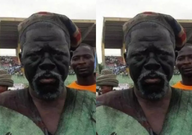 Nollywood Actor, Fadeyi Oloro Cries Out For Help As He Battles Strange Ailment