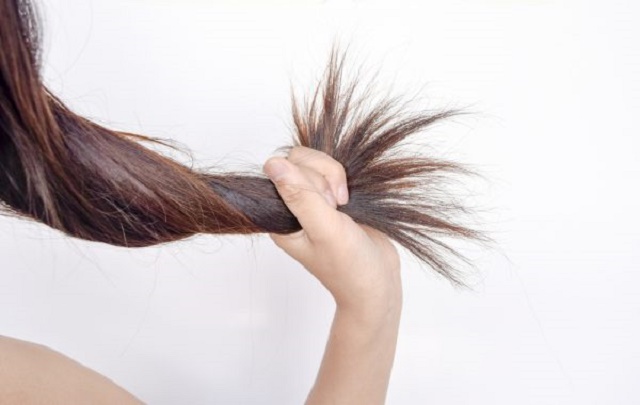 8 Things Your Hair Says About Your Health [#7 Can Cause Weak Hair]