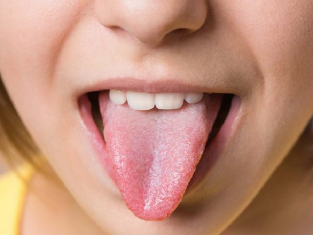 6 Things Your Tongue Says About Your Health [Bright Red Tongue Means See A Doctor]