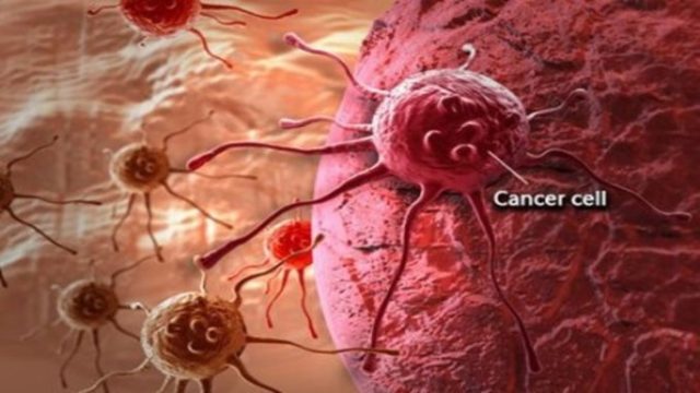 Three Types of Cancers That Kills Men, And How to Spot them before It’s Too Late
