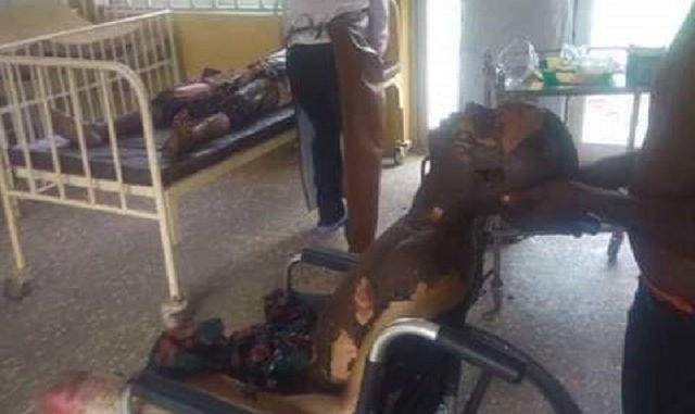 Tears Flows Like A River As Benue Tanker Explosion Kills 50, Injured 70 [Graphic Photos]