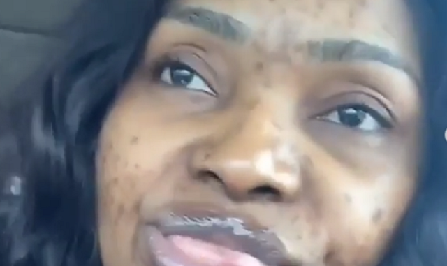Bold Halima Abubakar Shares Makeup-Free Photos of Her Face to Show What She Was Dealing With