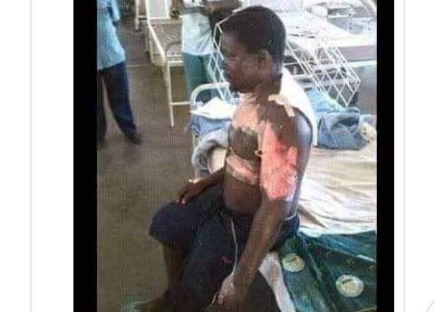 Coronavirus: Nigerians React As Angry Wife Sets Husband And Sister On Fire Amid Lockdown